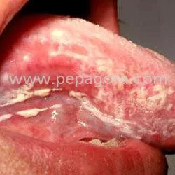 MTY2MTg=/mediabank/images/products/AntifungalDrugs434298520_16618.webp