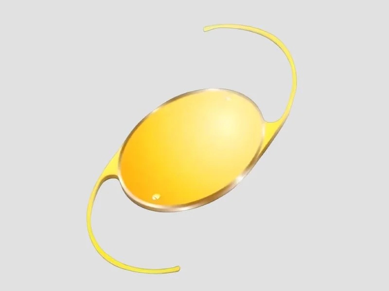 Yellow PMMA  Aspheric Square Edge IOL