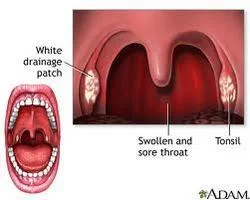 NjY1MQ==/mediabank/images/products/SoreThroatTreatment1269677354_6651.webp