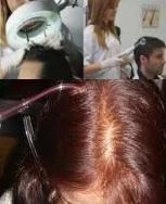 Ozone Hair Treatment