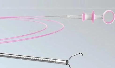 G- cLip Hemoclip Device