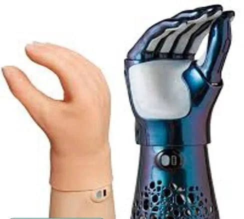 Myoelectric Hand with Mechanical Elbow for Advanced Upper Limb Prosthesis