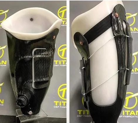 Revo Fit Socket for Prosthesis with Adjustable Dial System for Custom Fit