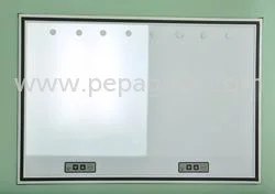 OTcwOA==/mediabank/images/products/DigitalX-RayViewingScreens533849427_9708.webp