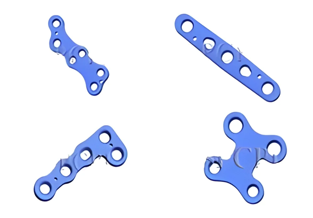 resizeImages/MzAwOQ==/mediabank/images/products/foot-locked-plating-system-250x250.webp