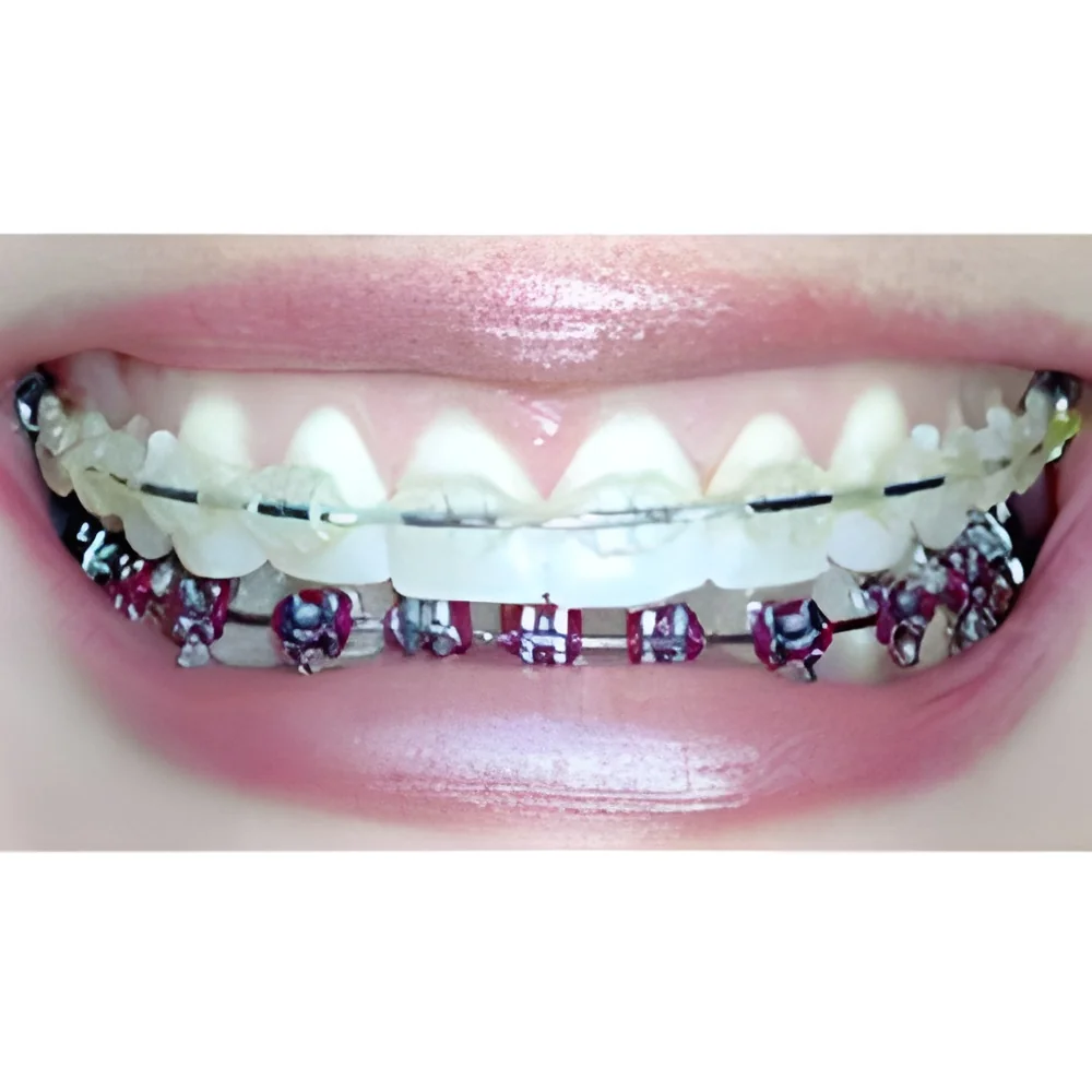 product-image-1